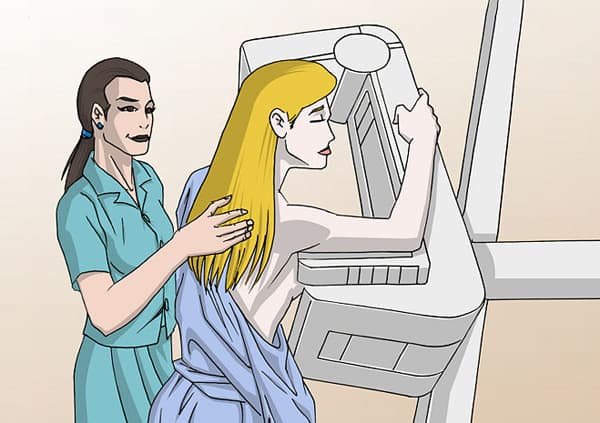 X quang vú phát hiện những bất thường sớm ở vú