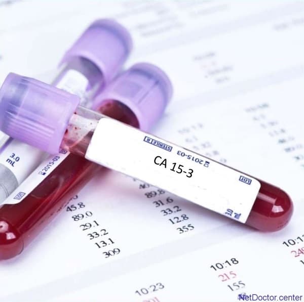 Kháng nguyên 15 – 3 (CA 15 – 3) là loại protein được tạo ra bởi nhiều loại tế bào, đặc biệt là các tế bào ung thư vú