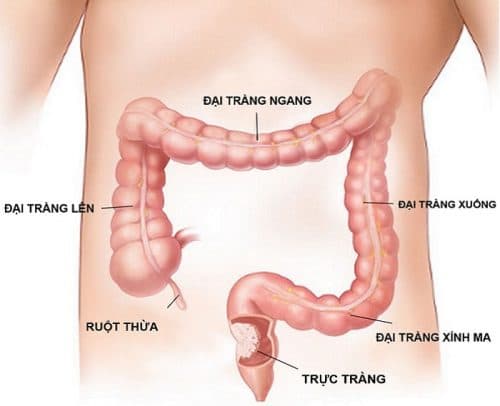 Trực tràng là một trong 4 phần chính cấu tạo nên đại tràng đó là: manh tràng, kết tràng, trực tràng và hậu môn.