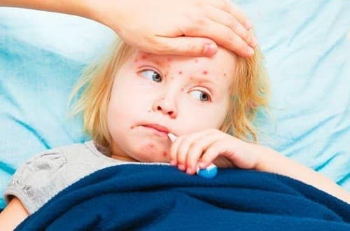 Trẻ mắc bệnh sởi thường có các triệu chứng như sốt, kết mạc mắt đỏ, mệt mỏi. chăm sóc trẻ mắc sởi đúng cách giúp bé cải thiện hơn