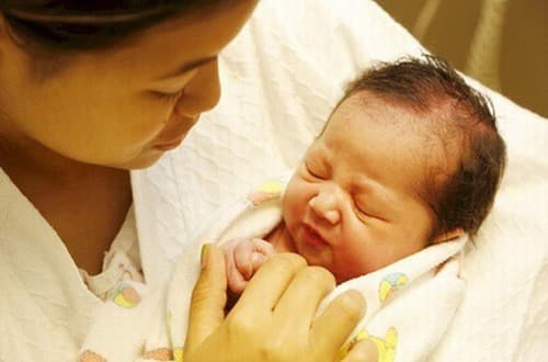 Dấu hiệu vàng da ở trẻ sơ sinh cần được cảnh giác vì có thể là vàng da bệnh lý nghiêm trọng