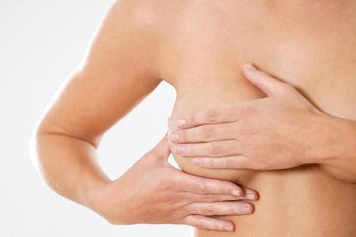 U xơ tuyến vú không nguy hiểm nhưng có thể gây khó chịu cho một số phụ nữ