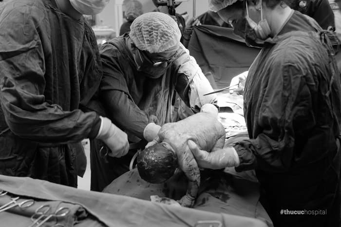 Một số trường hợp 