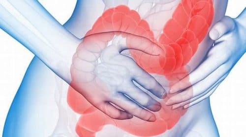 Nguyên nhân, biểu hiện viêm trực tràng xuất huyết