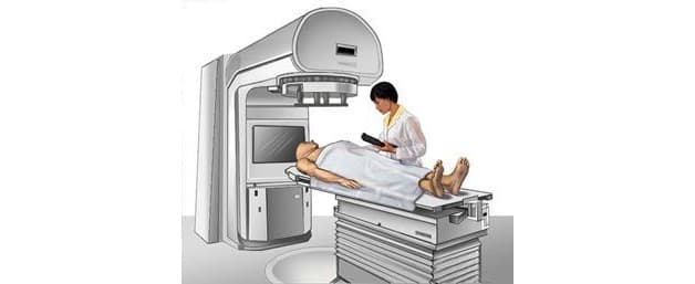 Chữa bệnh ung thư vòm họng ở đâu tốt hiện nay