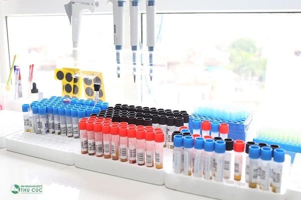 phân biệt ung thư buồng trứng và hội chứng ruột kích thích