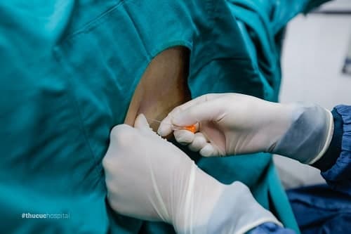 Nhật ký đi đẻ 