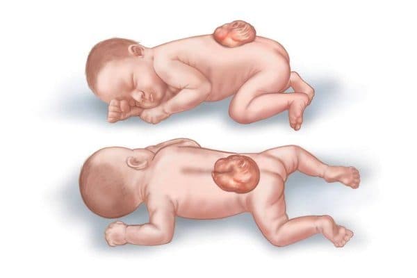 Xét nghiệm chỉ số dị tật ống thần kinh ở thai nhi - Triple test được thực hiện bằng cách đo lượng các chất hóa sinh trong máu mẹ.