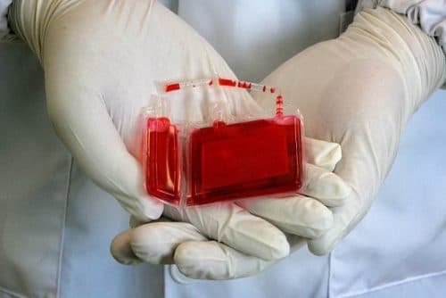 Lưu trữ tế bào gốc được coi như một loại bảo hiểm sinh học cho bé và cả gia đình trong tương lai