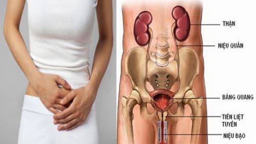 Mổ mở lấy sỏi niệu quản là phương pháp điều trị truyền thống đối với sỏi tiết niệu nói chung, sỏi niệu quản nói riêng. 