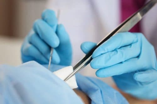 Để biết chính xác nguyên nhân gây rò hậu môn, người bệnh cần được thăm khám lâm sàng và cận lâm sàng. 