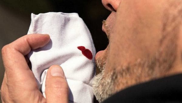 Ung thư vòm họng di căn phổi sẽ gây ra các triệu chứng như đau tức ngực, khó thở, ho ra máu...