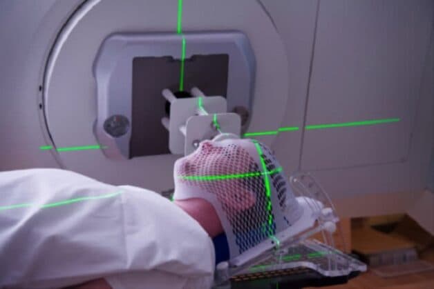 Điều trị bệnh ung thư tuyến nước bọt thế nào?