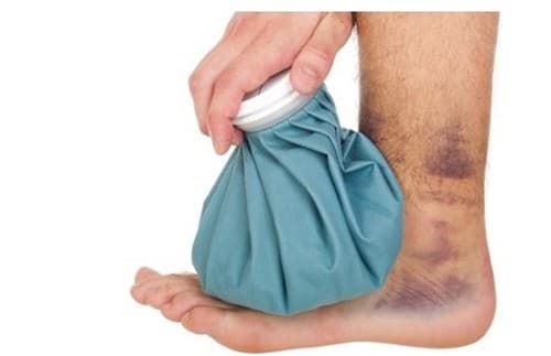 Cách chữa trẹo cổ chân nhanh khỏi nhất