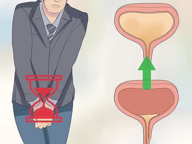 nguyên nhân dẫn đến chỉ số LEU 500 trong nước tiểu 