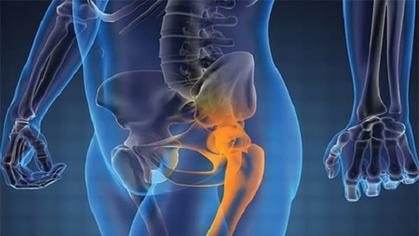 Đau xương khớp háng
