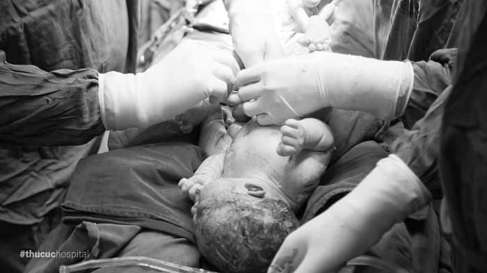 Phương pháp đẻ mổ đảm bảo sự an toàn cho thai nhi