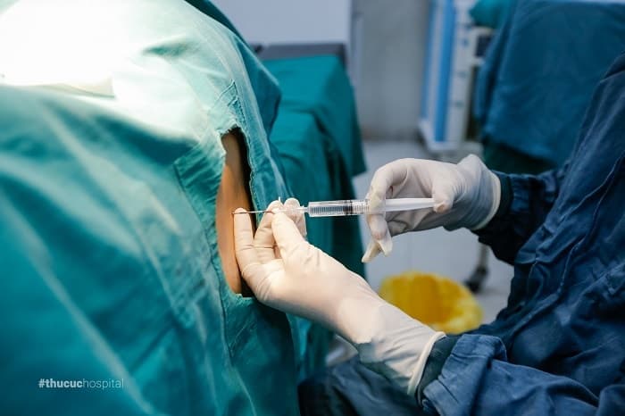 Sinh không đau bằng Phương pháp gây tê tủy sống