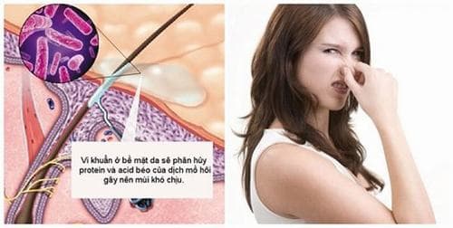 Có rất nhiều nguyên nhân gây ra tình trạng mồ hôi có mùi chua