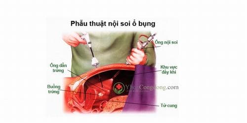  Hình ảnh bên trong khoang bụng được bác sĩ quan sát thông qua con mắt của thiết bị.