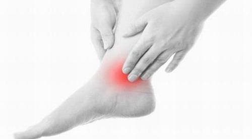 Các Dạng Viêm Khớp Chân &amp; Phương pháp điều Trị Hiệu Quả nhất