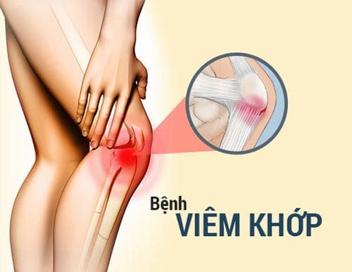 Có nhiều dạng viêm khớp chân