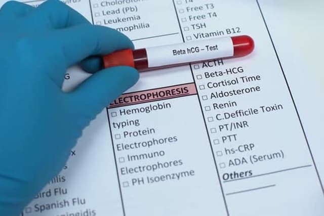 Xét nghiệm beta hcg âm tính nhưng vẫn có thai là sao?