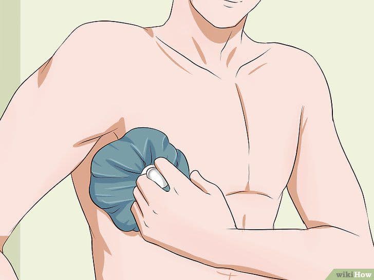 bị gãy xương đòn bao lâu có thể chạy xe lại được