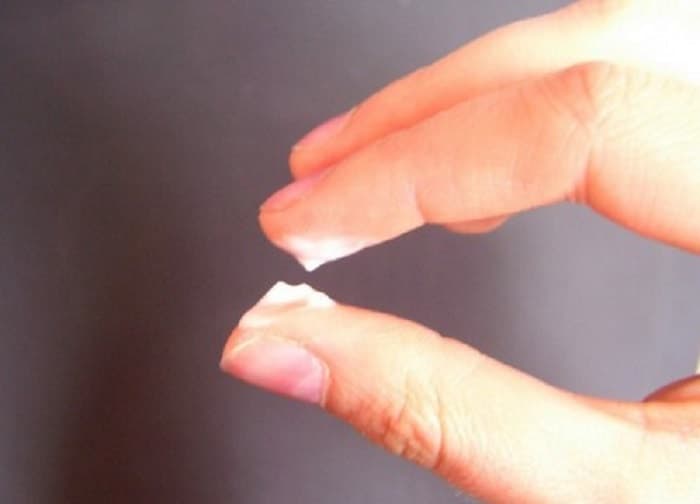 Khí hư ra nhiều và đặc