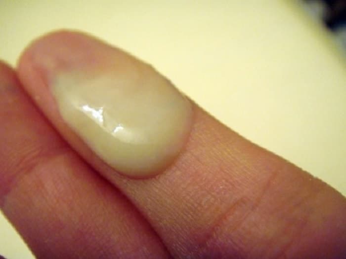 Khí hư màu vàng là một trong những dấu hiệu bất thường của cơ thể