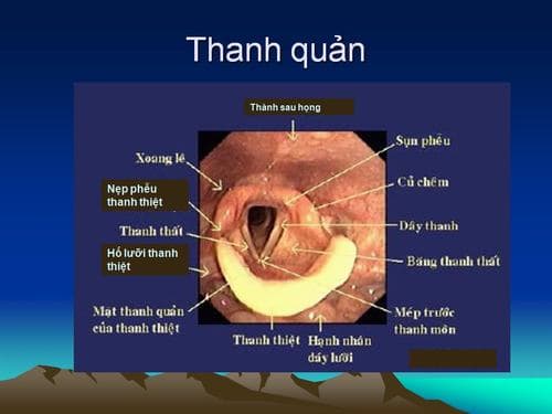 Nội soi họng có phải nhịn ăn không
