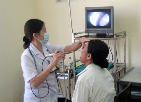 Nội soi vòm họng tầm soát ung thư
