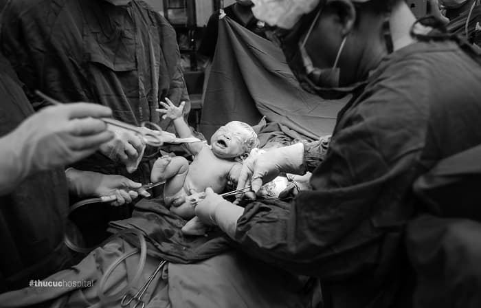 Mẹ bầu sinh mổ có nguy cơ mất máu cao hơn sinh thường. Nhưng các bác sĩ sẽ xử lý được vấn đề này.