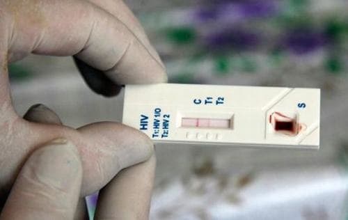 Xét nghiệm HIV bao lâu thì có kết quả là nỗi băn khoăn của nhiều người khi có nhu cầu làm xét nghiệm này. 