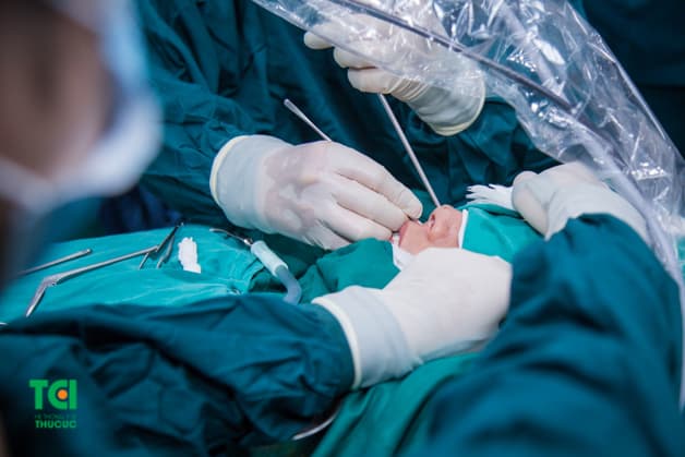 Phẫu thuật nội soi mũi xoang tại Bệnh viện Thu Cúc