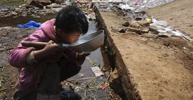 Phương pháp điều trị viêm gan E