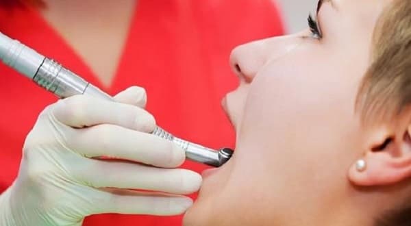 Ung thư tuyến nước bọt giai đoạn đầu