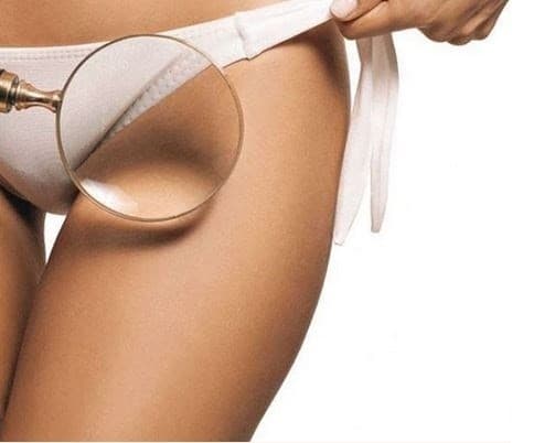 Nổi hạch ở háng có nguy hiểm không?