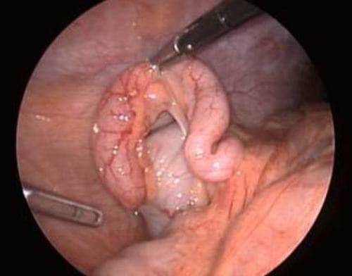 Nhờ quan sát hình ảnh nội soi bàng quang, các bác sĩ có thể phát hiện nguyên nhân gây ra những triệu chứng có liên quan mà người bệnh gặp phải.