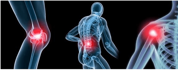 Ung thư vòm họng di căn xương gây ra các khó chịu ở xương khớp như đau mỏi, dễ nứt, gãy