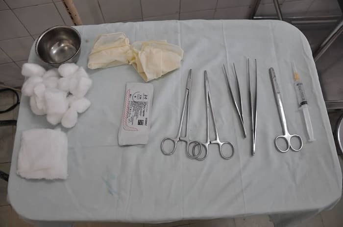 Hiện nay vết rạch tầng sinh môn đều được khâu bằng chỉ tự tiêu nên các mẹ hoàn toàn không cần lo về việc sau bao lâu cắt chỉ, cắt chỉ có đau không.