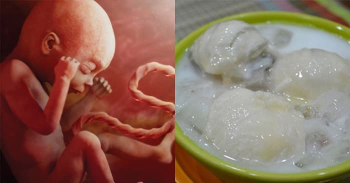 Tuy có nhiều tác dụng tích cực nhưng các chuyên gia vẫn khuyến cáo mẹ bầu chỉ nên ăn vú sữa với hàm lượng nhất định, không được lạm dụng.