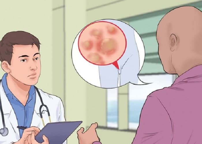 Khi phát hiện triệu chứng sùi mào gà nên đến ngay các cơ sở y tế