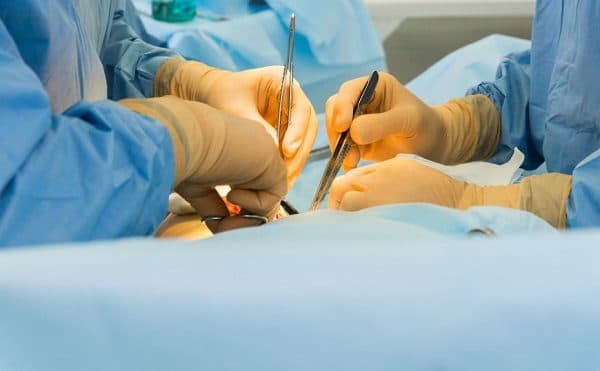 Phẫu thuật là một trong những phương pháp thường được chỉ định trong điều trị ung thư phổi giai đoạn đầu