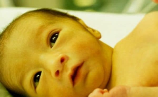                      Vàng da ở trẻ sơ sinh gồm hai loại vàng da sinh lý và vàng da bệnh lý (ảnh minh họa).