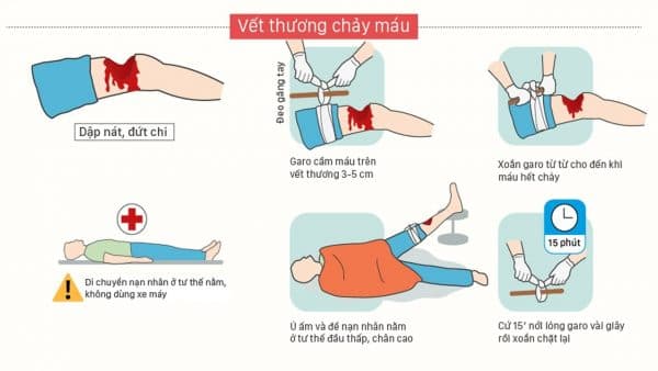 Cach sơ cứu cầm máu