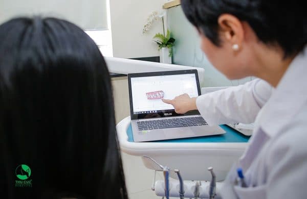 Niềng răng chuẩn v-line