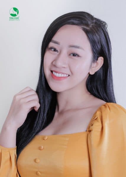 niềng răng mặt thon