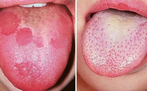 Khám lưỡi ở bệnh viện nào tốt là câu hỏi nhiều người đang quan tâm.