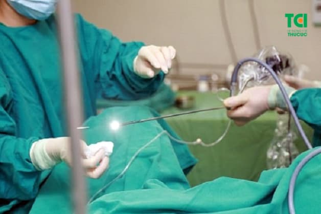 Điều trị sỏi niệu quản bằng phương pháp tán sỏi nội soi ngược dòng tại Thu Cúc.